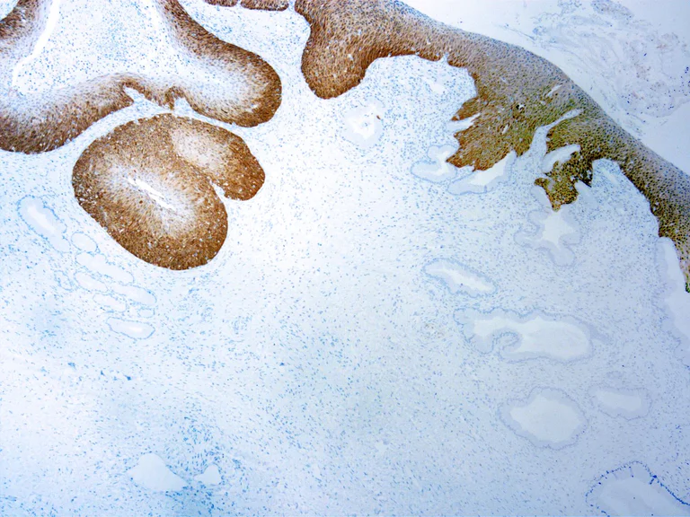 Immunohistochemistry (Formalin/PFA-fixed paraffin-embedded sections) - Anti-CDKN2A/p16INK4a antibody [JC2] (AB267833)