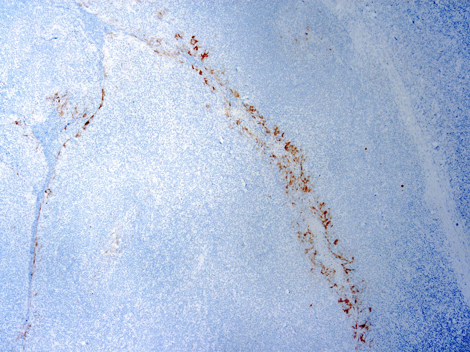 Immunohistochemistry (Formalin/PFA-fixed paraffin-embedded sections) - Anti-CDKN2A/p16INK4a antibody [JC2] (AB267833), expandable thumbnail