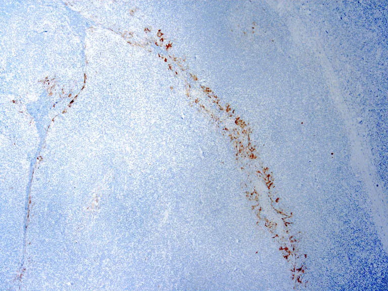 Immunohistochemistry (Formalin/PFA-fixed paraffin-embedded sections) - Anti-CDKN2A/p16INK4a antibody [JC2] (AB267833)