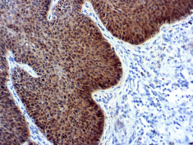 Immunohistochemistry (Formalin/PFA-fixed paraffin-embedded sections) - Anti-CDKN2A/p16INK4a antibody [JC2] (AB267833)