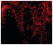 Immunocytochemistry/ Immunofluorescence - Anti-CDKN2A/p16INK4a antibody - N-terminal (AB189034), expandable thumbnail