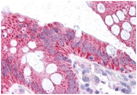Immunohistochemistry (Formalin/PFA-fixed paraffin-embedded sections) - Anti-CDKN2A/p16INK4a antibody - N-terminal (AB189034), expandable thumbnail