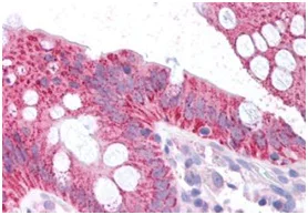 Immunohistochemistry (Formalin/PFA-fixed paraffin-embedded sections) - Anti-CDKN2A/p16INK4a antibody - N-terminal (AB189034)