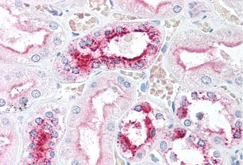Immunohistochemistry (Formalin/PFA-fixed paraffin-embedded sections) - Anti-CDKN2A/p16INK4a antibody - N-terminal (AB189034)