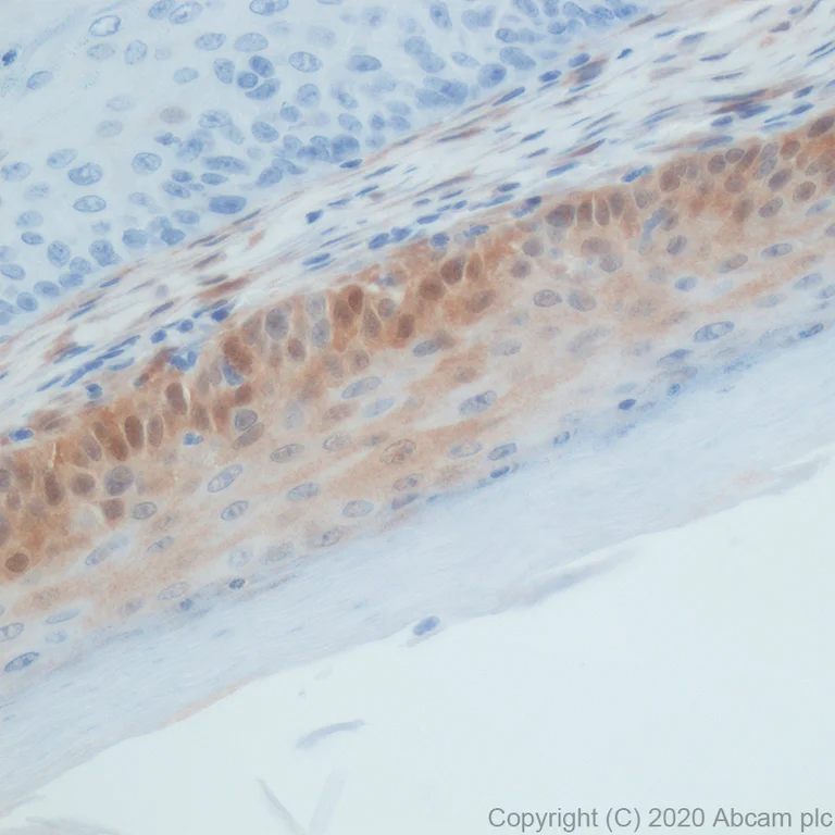Immunohistochemistry (Formalin/PFA-fixed paraffin-embedded sections) - Anti-CDKN2A/p16INK4a antibody [PABLO33B] (AB241543)