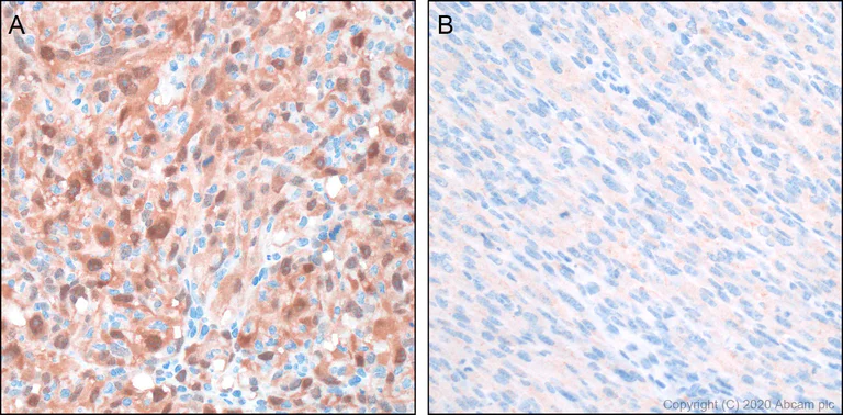 Immunohistochemistry (Formalin/PFA-fixed paraffin-embedded sections) - Anti-CDKN2A/p16INK4a antibody [PABLO33B] - BSA and Azide free (AB252788)