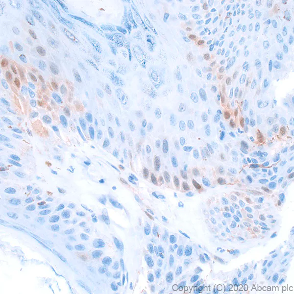 Immunohistochemistry (Formalin/PFA-fixed paraffin-embedded sections) - Anti-CDKN2A/p16INK4a antibody [PABLO33B] - BSA and Azide free (AB252788)