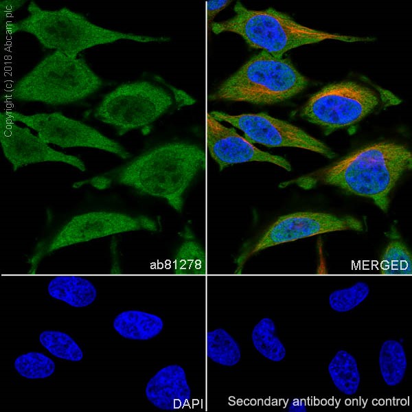 Immunocytochemistry/ Immunofluorescence - Anti-CDKN2A/p16INK4A + CDKN2B/p15INK4B antibody [EP435Y-129R] (AB81278)