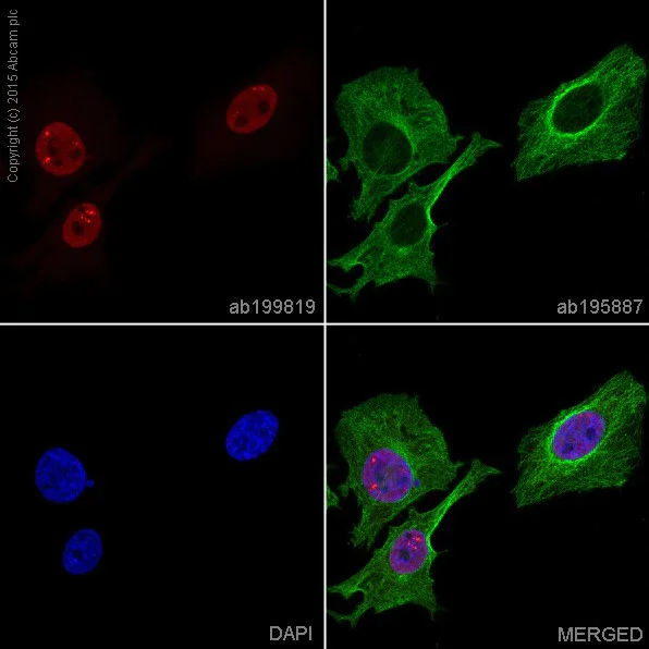 CDKN2A/p16INK4A + CDKN2B/p15INK4B抗体[EP435Y-129R] - BSA and Azide free ...