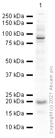Western blot - Anti-CDKN2A/p19ARF antibody [5-C3] (AB26696)