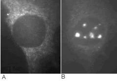 Immunocytochemistry - Anti-CDKN2A/p19ARF antibody (AB80)