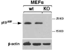 Western blot - Anti-CDKN2A/p19ARF antibody (AB80)