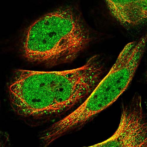 Immunocytochemistry/ Immunofluorescence - Anti-CDKN2AIP antibody (AB122715)