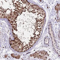 Immunohistochemistry (Formalin/PFA-fixed paraffin-embedded sections) - Anti-CDKN2AIP antibody (AB122715)