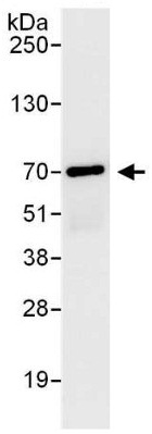 Immunoprecipitation - Anti-CDKN2AIP antibody (AB140519), expandable thumbnail