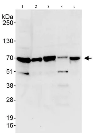 Western blot - Anti-CDKN2AIP antibody (AB140519)
