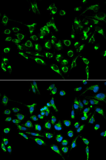Immunocytochemistry/ Immunofluorescence - Anti-CDKN3 antibody (AB175393)