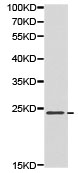 Western blot - Anti-CDKN3 antibody (AB175393)