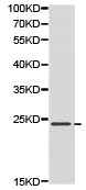 Western blot - Anti-CDKN3 antibody (AB175393)