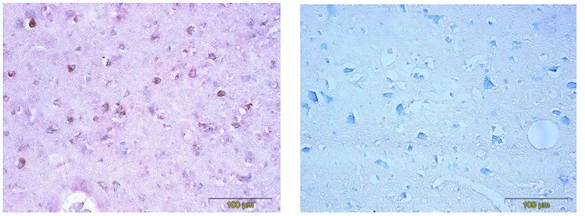 Immunohistochemistry (Formalin/PFA-fixed paraffin-embedded sections) - Anti-CDNF antibody [6G5] (AB205551)