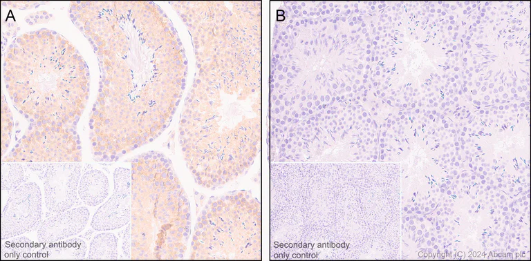 Immunohistochemistry (Formalin/PFA-fixed paraffin-embedded sections) - Anti-CDNF antibody [EPR22334-99] - BSA and Azide free (AB254214)