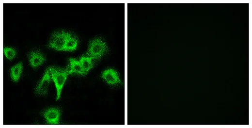 Immunocytochemistry/ Immunofluorescence - Anti-CDON / Cdo antibody (AB196593)