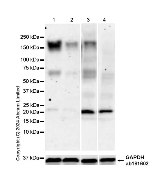 Western blot - Anti-CDON / Cdo antibody [EPR29370-544] - BSA and Azide free (AB324832)