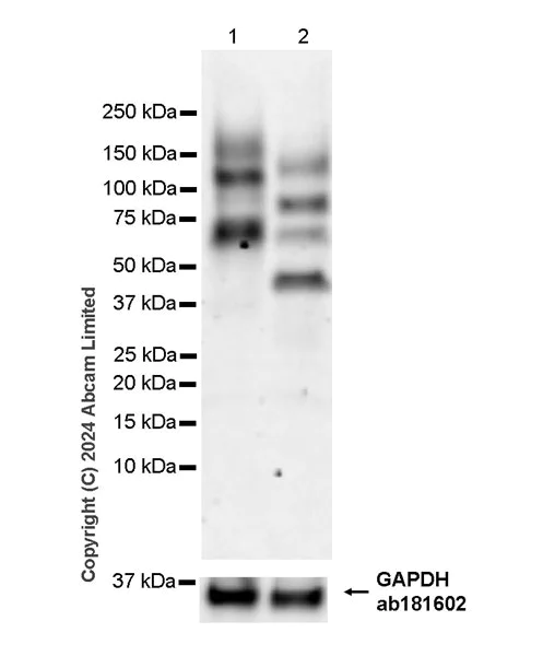Western blot - Anti-CDON / Cdo antibody [EPR29370-544] - BSA and Azide free (AB324832)