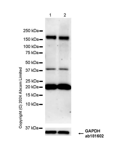 Western blot - Anti-CDON / Cdo antibody [EPR29370-544] - BSA and Azide free (AB324832)