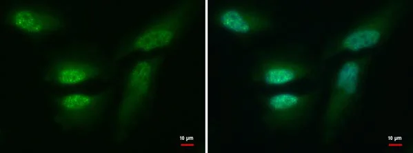 Immunocytochemistry/ Immunofluorescence - Anti-CDR2 antibody (AB183845)