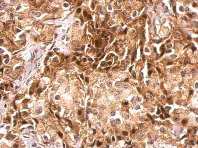 Immunohistochemistry (Formalin/PFA-fixed paraffin-embedded sections) - Anti-CDR2 antibody (AB183845)