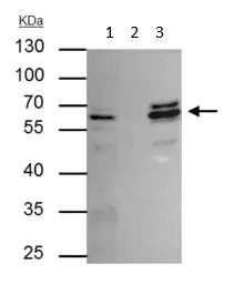 Immunoprecipitation - Anti-CDR2 antibody (AB183845)