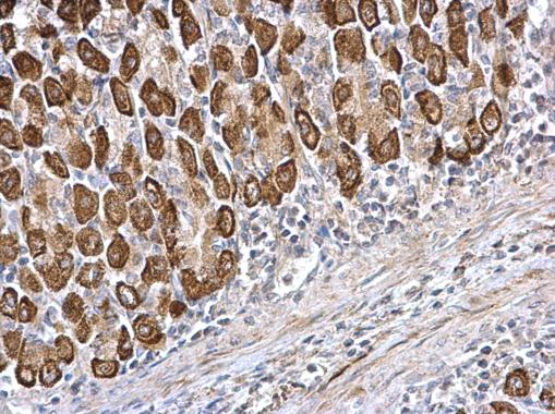 Immunohistochemistry (Formalin/PFA-fixed paraffin-embedded sections) - Anti-CDS1 antibody (AB278496)