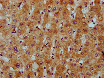 Immunohistochemistry (Formalin/PFA-fixed paraffin-embedded sections) - Anti-CDS2 antibody (AB234973)