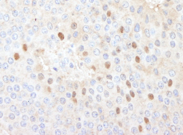 Immunohistochemistry (Formalin/PFA-fixed paraffin-embedded sections) - Anti-CDT1/DUP antibody (AB70829)