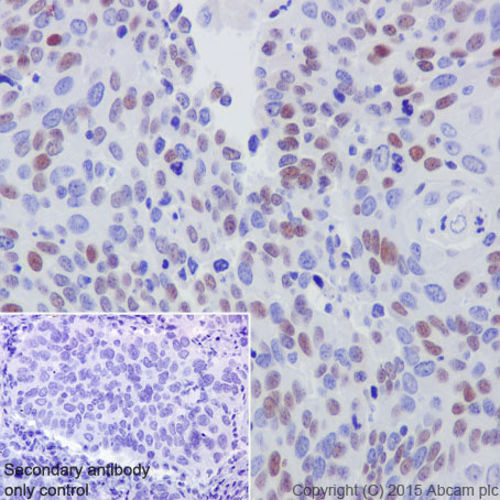 Immunohistochemistry (Formalin/PFA-fixed paraffin-embedded sections) - Anti-CDT1/DUP antibody [EPR17891] (AB202067), expandable thumbnail
