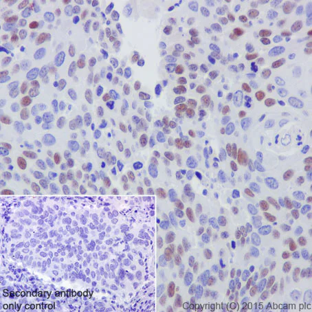 Immunohistochemistry (Formalin/PFA-fixed paraffin-embedded sections) - Anti-CDT1/DUP antibody [EPR17891] (AB202067)