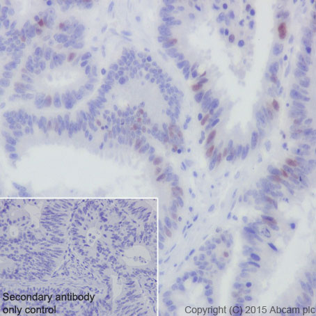 Immunohistochemistry (Formalin/PFA-fixed paraffin-embedded sections) - Anti-CDT1/DUP antibody [EPR17891] (ab202067), expandable thumbnail