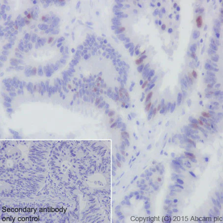 Immunohistochemistry (Formalin/PFA-fixed paraffin-embedded sections) - Anti-CDT1/DUP antibody [EPR17891] (AB202067)