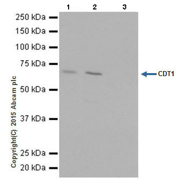 Immunoprecipitation - Anti-CDT1/DUP antibody [EPR17891] (AB202067), expandable thumbnail