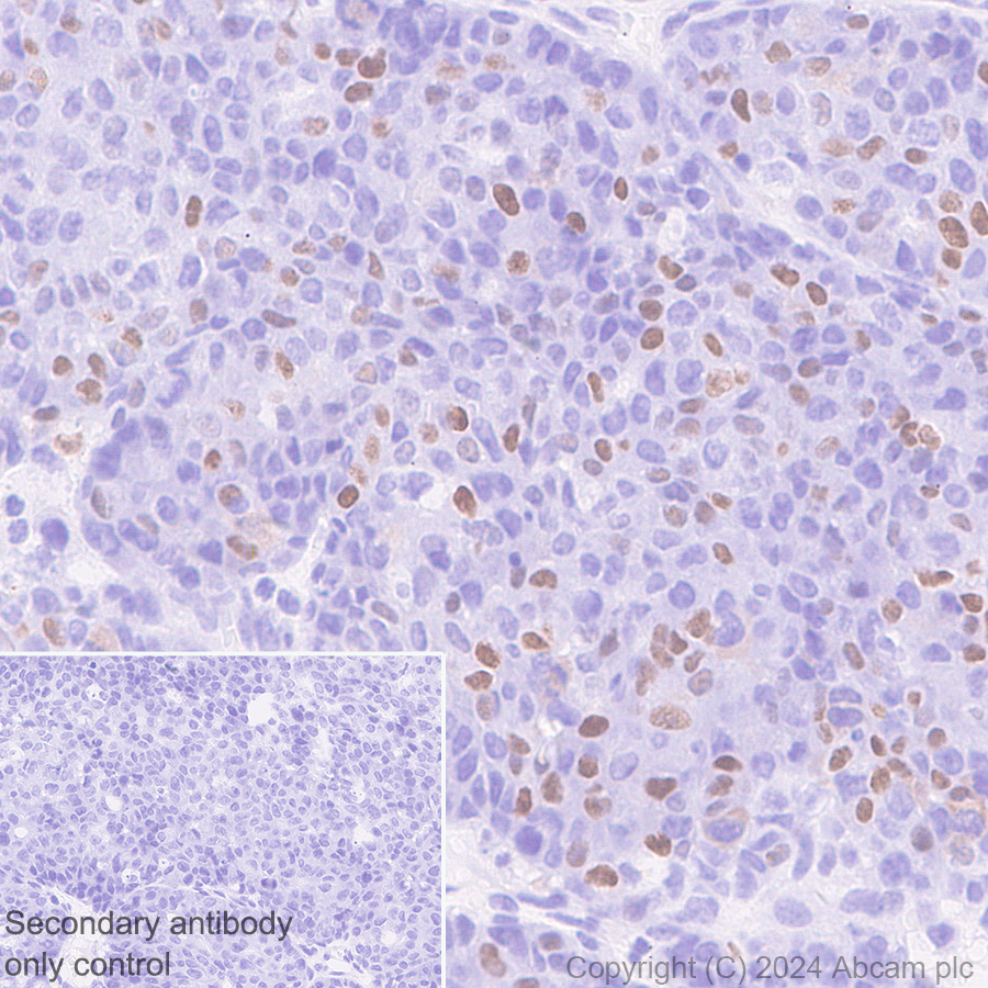 Immunohistochemistry (Formalin/PFA-fixed paraffin-embedded sections) - Anti-CDT1/DUP antibody [EPR27439-67] - BSA and Azide free (ab316962), expandable thumbnail