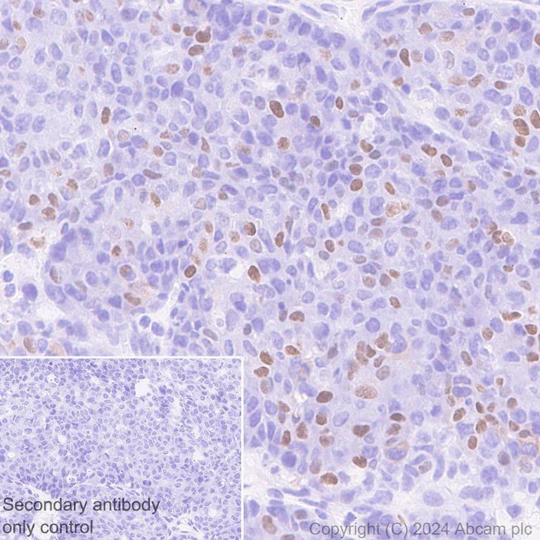 Immunohistochemistry (Formalin/PFA-fixed paraffin-embedded sections) - Anti-CDT1/DUP antibody [EPR27439-67] - BSA and Azide free (AB316962)