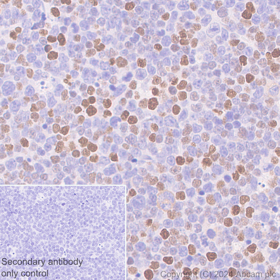 Immunohistochemistry (Formalin/PFA-fixed paraffin-embedded sections) - Anti-CDT1/DUP antibody [EPR27439-67] - BSA and Azide free (ab316962), expandable thumbnail