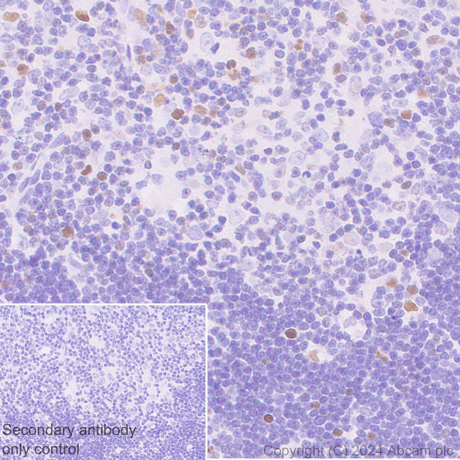 Immunohistochemistry (Formalin/PFA-fixed paraffin-embedded sections) - Anti-CDT1/DUP antibody [EPR27439-67] - BSA and Azide free (ab316962), expandable thumbnail
