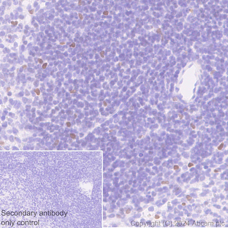Immunohistochemistry (Formalin/PFA-fixed paraffin-embedded sections) - Anti-CDT1/DUP antibody [EPR27439-67] - BSA and Azide free (AB316962)