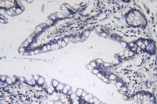 Immunohistochemistry (Formalin/PFA-fixed paraffin-embedded sections) - Anti-CDT1/DUP antibody [SR3533] (AB326693)