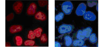 Immunocytochemistry/ Immunofluorescence - Anti-CDT2/RAMP antibody (AB174385), expandable thumbnail