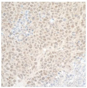 Immunohistochemistry (Formalin/PFA-fixed paraffin-embedded sections) - Anti-CDT2/RAMP antibody (AB72264)
