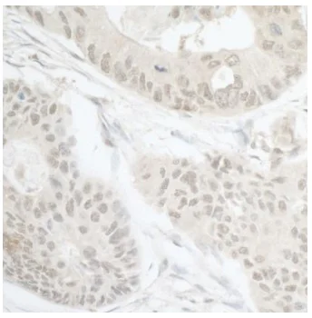Immunohistochemistry (Formalin/PFA-fixed paraffin-embedded sections) - Anti-CDT2/RAMP antibody (AB72264)