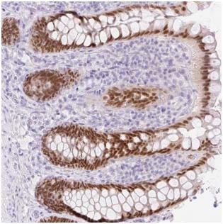 Immunohistochemistry (Formalin/PFA-fixed paraffin-embedded sections) - Anti-Cdx1 antibody (AB188072)